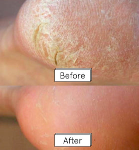 dr. pedicure foot peeling mask